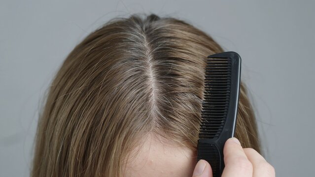 Hair Scalp Inspection with Fine Tooth Comb, Head Lice Detection, Hair Care Hygiene and Medical Examination Concept