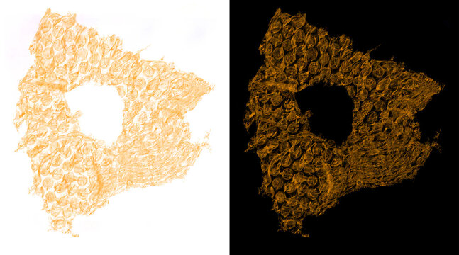 Microscopic liver tissue section, biological cell structure of hepatic lobule, orange stained histology sample on white and black background