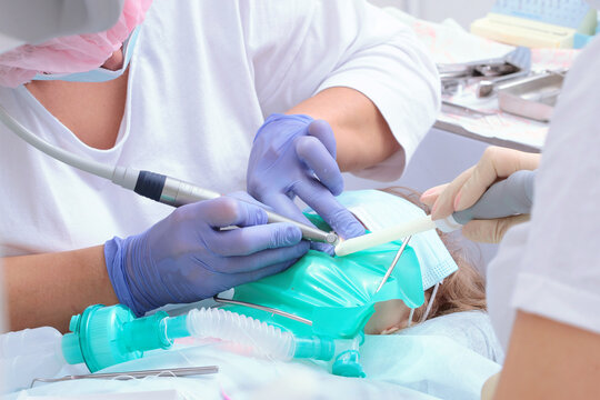 Treatment of baby teeth under anesthesia. Child is under general anesthesia. Breathing tube in baby's mouth. Dental services for children. Concept of modern medicine