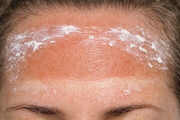 Fototapeta premium A close-up shot of a person's forehead covered in white frost or sweat
