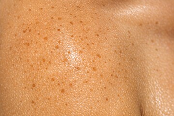 Fototapeta premium A detailed view of a person's facial features, with distinctive freckles
