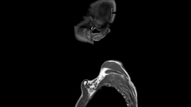 Cinematic sagittal MRI scan video of human neck detailing the cervical spine column pharynx larynx and airway path