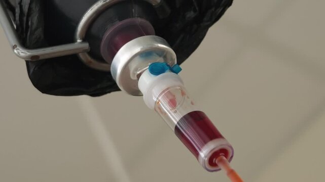 Medical procedure, IV drip. Administration of iron preparations into the human body through a dropper. Anemia treatment