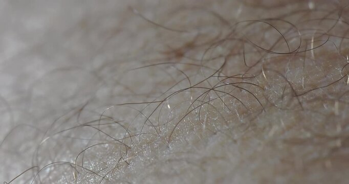 : Super Macro 5X - Hairs of a human quadriceps