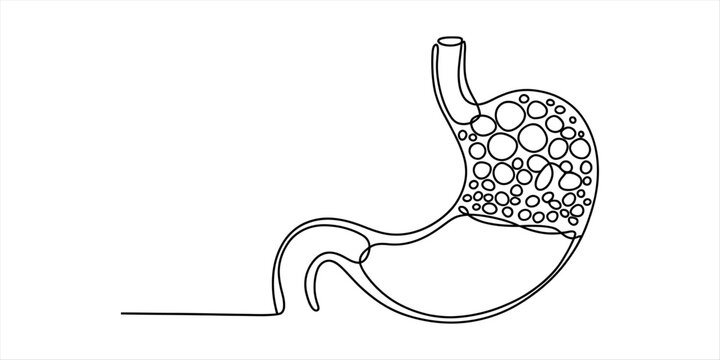 Continuous single line drawing of a human stomach with gas bubbles representing bloating and digestion issues in a minimalist medical vector illustration