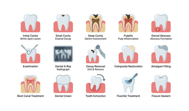 Dental icons showing stages of tooth decay and treatments