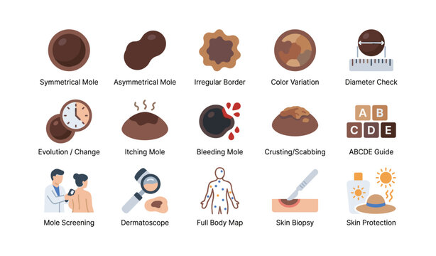 Mole warning signs and screening icons in medical infographic