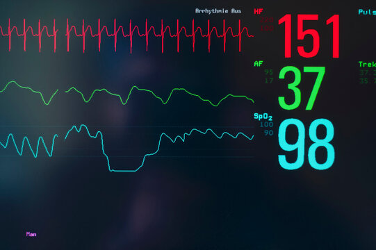 Close-up of EKG screen display