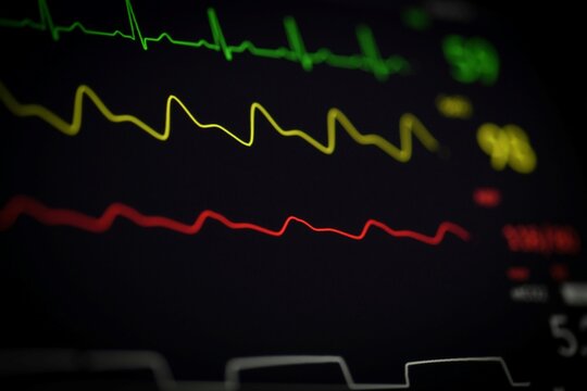 Medical heart rate monitor screen showing vital signs with copy space