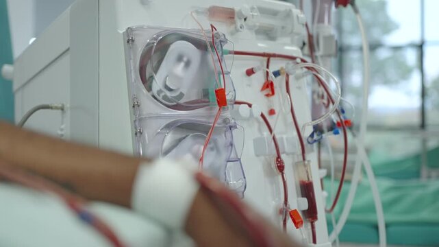 Patient arm with access site rests in foreground while an active hemodialysis machine runs in a clinical setting.