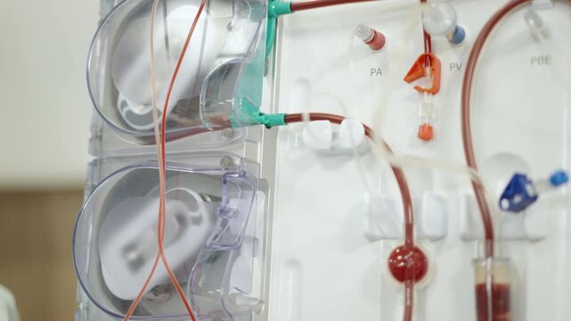 Rotating pump heads drive color-coded blood lines through a modern hemodialysis system in clinical use.