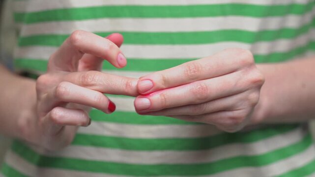Female removing red nail polish from fingers, showcasing before and after results of nail cleaning, home beauty routine and changing polish color.