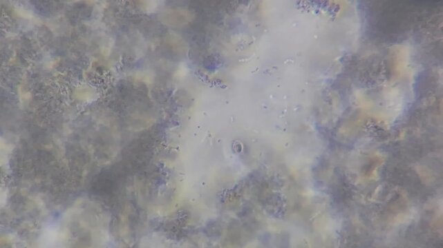 Microscopic view of lactic acid bacteria and casein matrix in cottage cheese