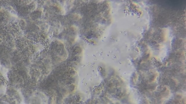 Microscopic view of lactic acid bacteria and casein matrix in cottage cheese