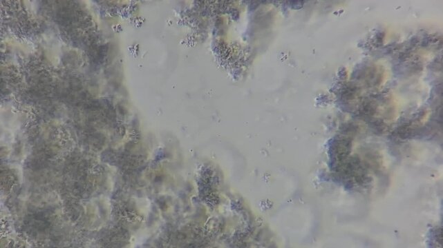 Microscopic view of lactic acid bacteria and casein matrix in cottage cheese
