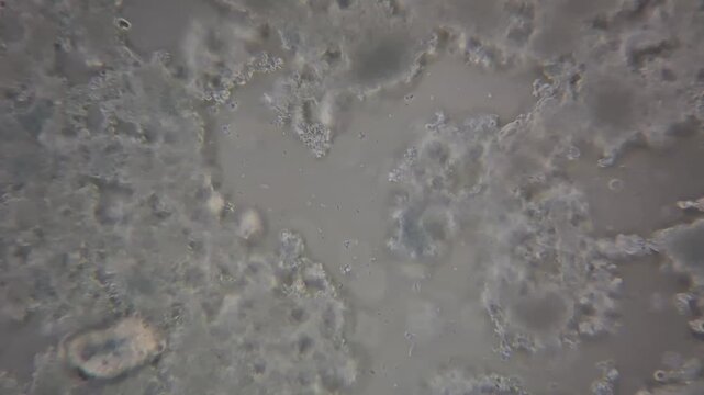 Microscopic view of lactic acid bacteria and casein matrix in cottage cheese