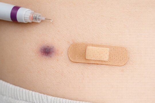 A close-up shot of a patch applied to a woman's stomach, specifically the belly button area