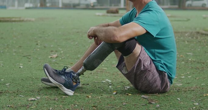 Side view of an adult with a lower limb prosthesis sitting quietly in a public park 