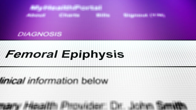 Generic Health Portal with Hip Health Problem Diagnosis - Femoral Epiphysis