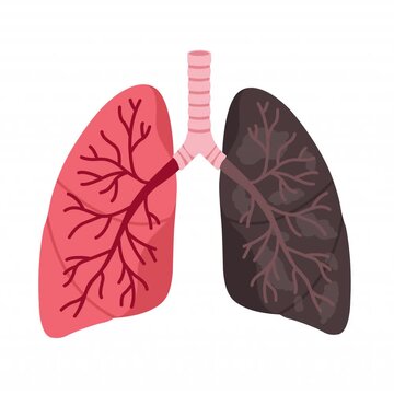 Human lungs comparison concept illustration, healthy pink lung and amaged black lung. Medical infographics element for smoking disease stages.
