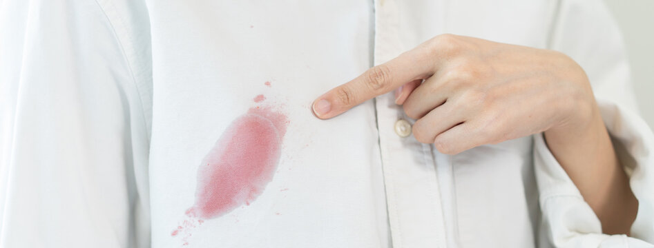Prepare before laundry, Close-up of hands holding the white shirt dirty by strawberry sauce.
