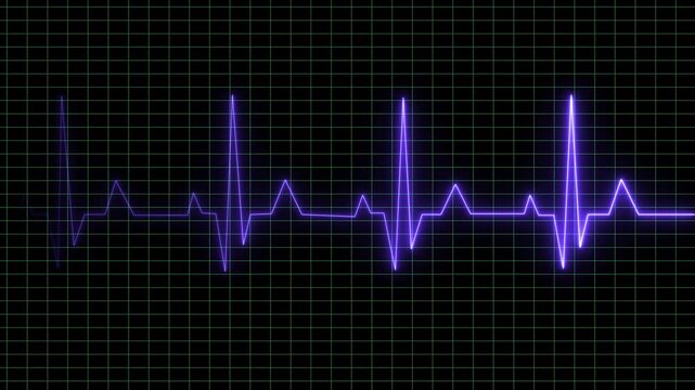 Electrocardiogram displays a rhythmic purple pulse pattern on a dark digital grid backdrop, representing continuous heart activity monitoring for medical diagnostic purposes and critical clinical.
