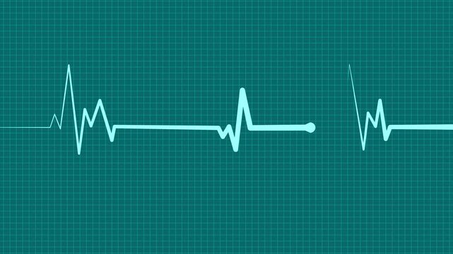 Health heartbeat line medical ekg rhythm pattern health monitor signal and heart activity chart animation