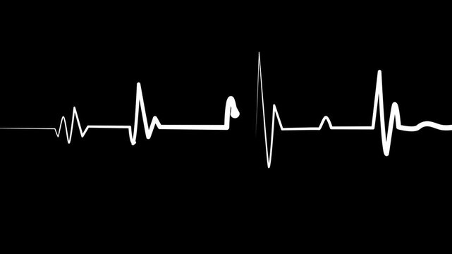 Heartbeat line showing an electrocardiogram rhythm animation