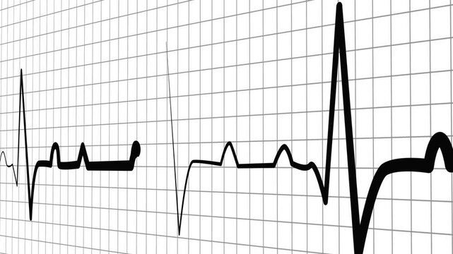 Health heartbeat line showing heart rhythm and medical monitor trace animation