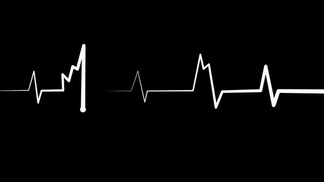 Abnormal heart rhythm line showing an ekg style medical waveform animation