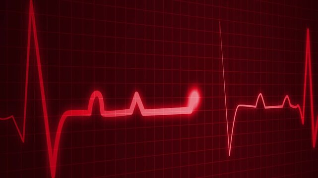 Health heartbeat line showing heart rhythm and medical monitor trace animation