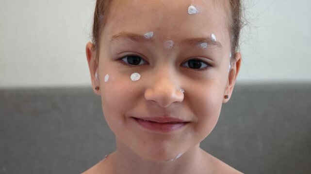 Portrait of girl with chickenpox on her face. Beautiful toddler girl is looking at camera and smiling. Chickenpox treatment at home. Girl with rash from chickenpox and with antiseptic on skin.