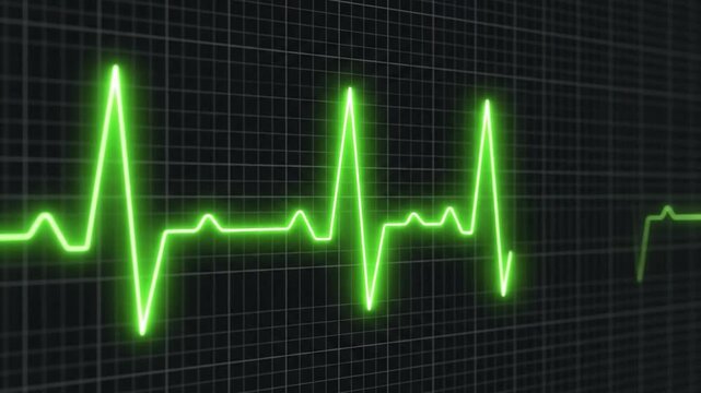 Green electrocardiogram heart rate monitor line pulsing across a dark medical grid display