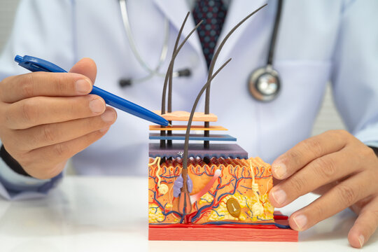 Hair transplant, Asian dermatologist doctor holding skin structure anatomy model for treatment in hospital.