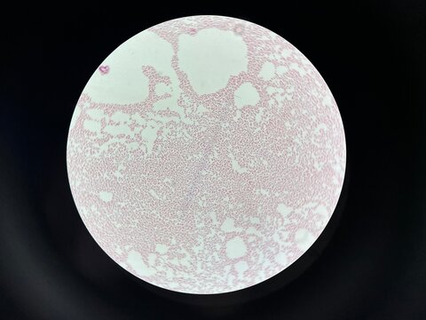 Gram negative bacteria