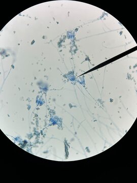 Penicillium Microscopic Morphology Under Light Microscope.