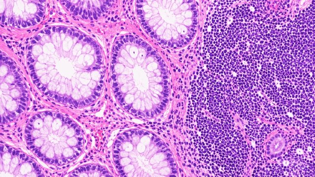 Microscopic view of tissue showing cellular structures in shades of pink and purple, illustrating complex biological patterns.