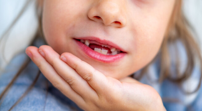 happy positive funny toothless 6-year-old girl, Close-up smiling child's face, showcasing missing baby teeth and joyful expression, waiting for toothfairy, innocence, growth, and childhood milestones