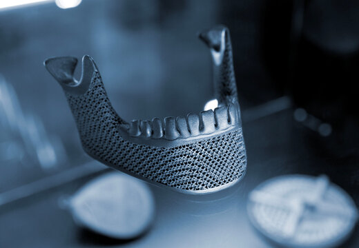 Object custom jaw printed on 3D printer from titanium. Model lower jaw printed 3D printer from metal powder. Selective Laser Melting. SLM. Additive new modern manufacturing. 3D printing technology