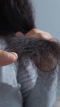 young woman her hair and have many hair loss. problem of maintenance losing by sad strain cancer patients after receiving chemotherapy. Healthcare and medical concept.	