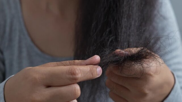 young woman her hair and have many hair loss. problem of maintenance losing by sad strain cancer patients after receiving chemotherapy. Healthcare and medical concept.