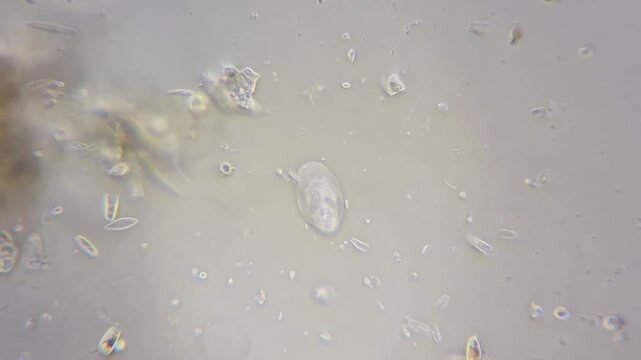 Microscopic timelapse of Amoeba, 4k