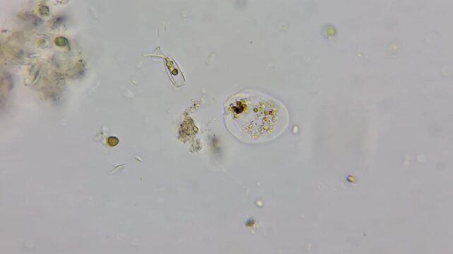 Microscopic timelapse of Amoeba feeding on diatoms in freshwater pond drop, 4k