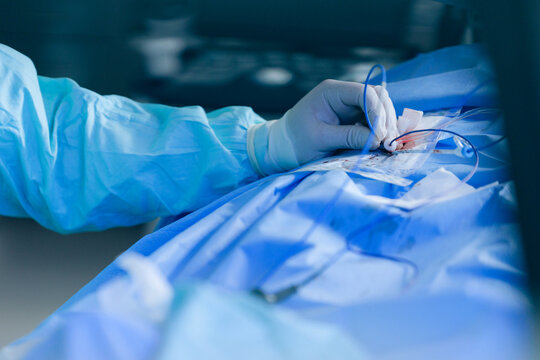 Closeup of surgeon hand during cardiac catheter insertion showing hub and sterile gauze on draped chest for clinical procedure