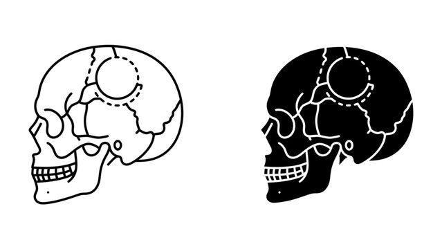 Skull Illustration Set: A side profile of a human skull presented in two distinct styles, one as a clean outline and the other as a solid black silhouette, showcasing anatomical detail.