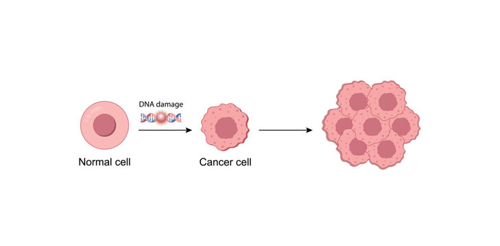 Normal cell and cancer cells. Cancer development. Carcinogens, DNA damage. Malignant tumor. Difference between normal and tumor cells. Scientific design. Vector Illustration.