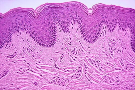 Stratified epithelial skin tissue under light microscope