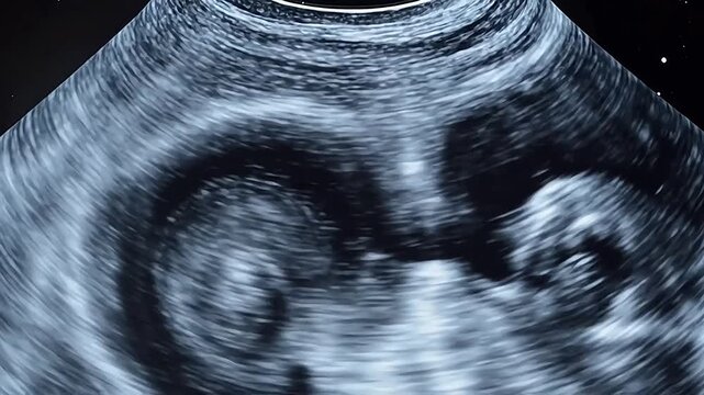 Vibrant Heart Valve Animation with Doppler Flow