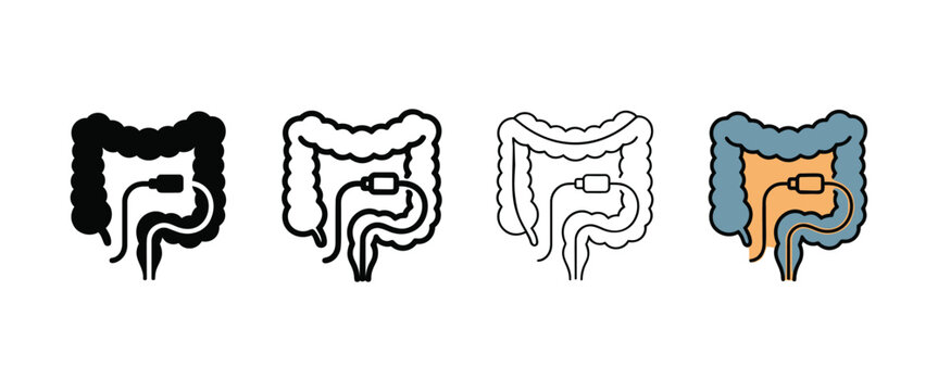 Medical illustration of the human colon with a connected endoscopic capsule for internal examination