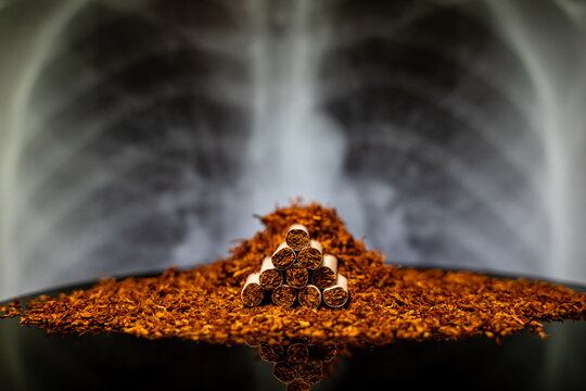 Close up of cigarettes with loose tobacco and chest X ray background.